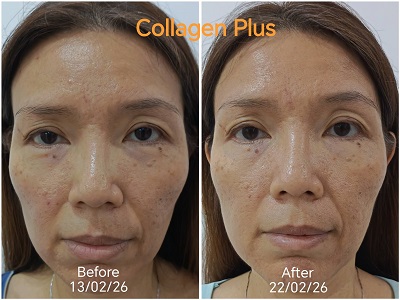 Collagen Plus results Malaysia