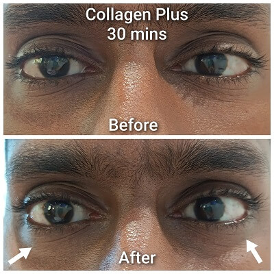 Belixz Collagen Plus reduce fine lines