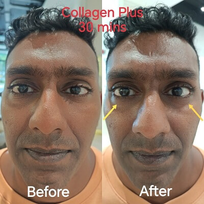 Belixz Collagen Plus men result