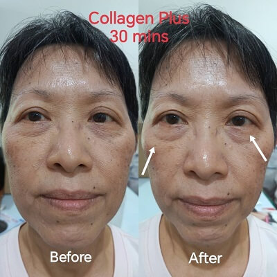 Belixz Collagen Plus woman testimonial