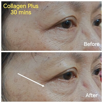 Collagen Plus eye fine lines 