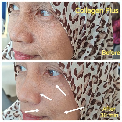 Belixz Collagen Plus test results