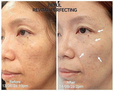 Mommy Lynn Beyul Revital Perfecting results
